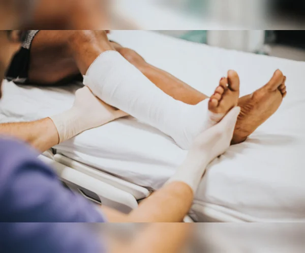 Fracture Management